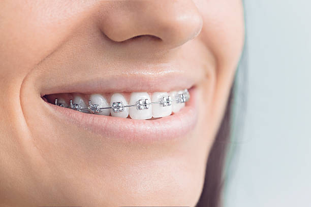 Best Traditional Braces  in Memphis, TX